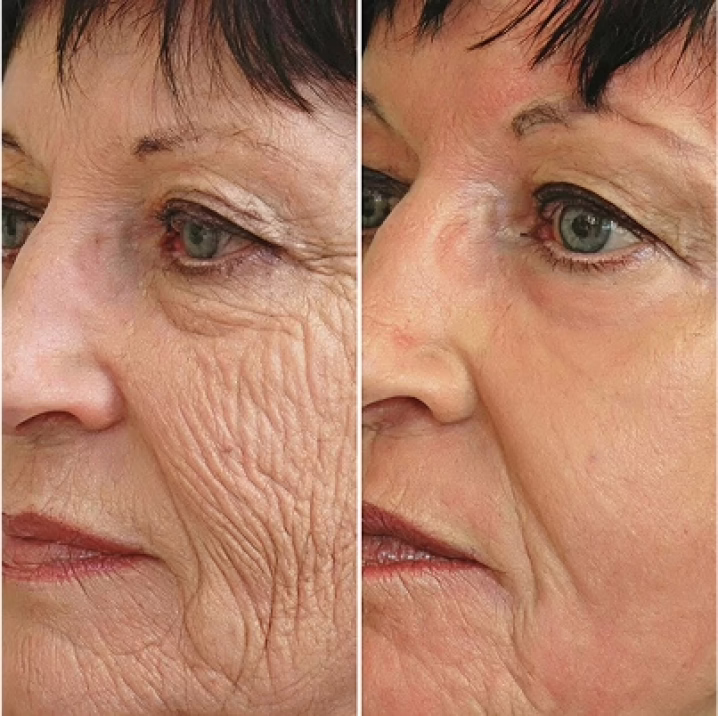 Second GloraMD brand-supplied skin comparison