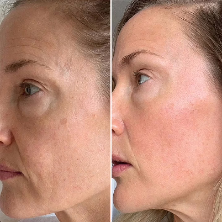 First GloraMD brand-supplied skin comparison